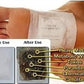 Detox Foot Patches Pads – Stress Relief & Body Cleanse
